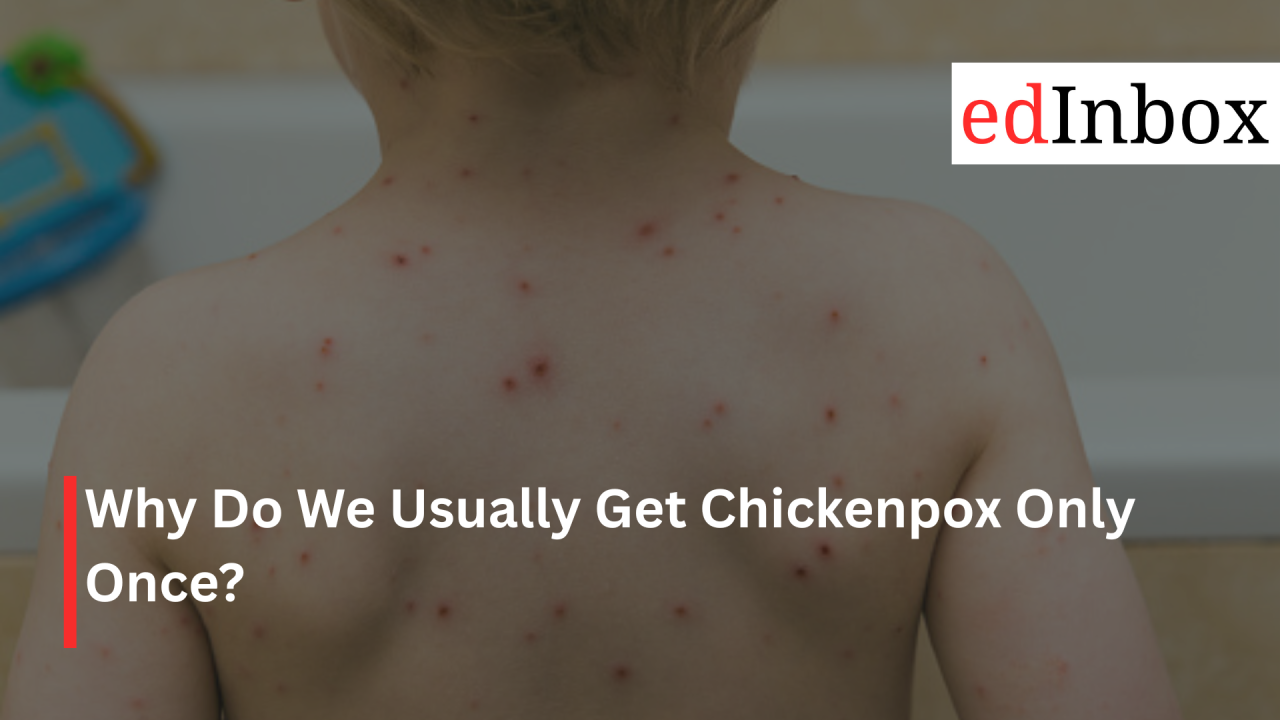 Why Do We Usually Get Chickenpox Only Once?