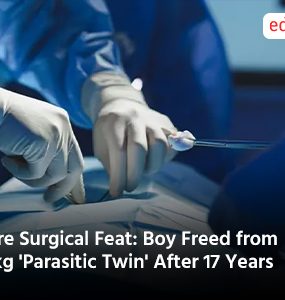 Rare Surgical Feat: Boy Freed from 15kg 'Parasitic Twin' After 17 Years