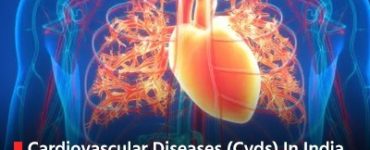 Cardiovascular Diseases (Cvds) In India Continues To Grow Rapidly: What Is The Future Of BSc CVT