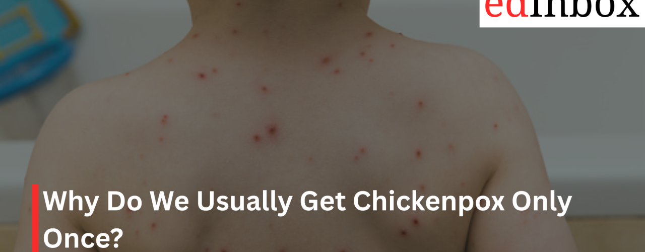 Why Do We Usually Get Chickenpox Only Once?