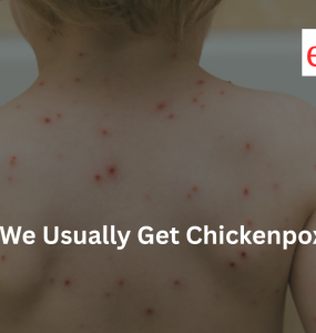 Why Do We Usually Get Chickenpox Only Once?