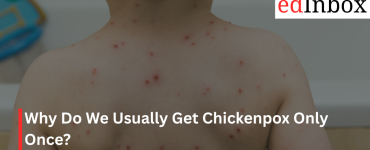 Why Do We Usually Get Chickenpox Only Once?